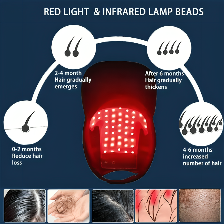 Red Light Hair Regrowth Hat