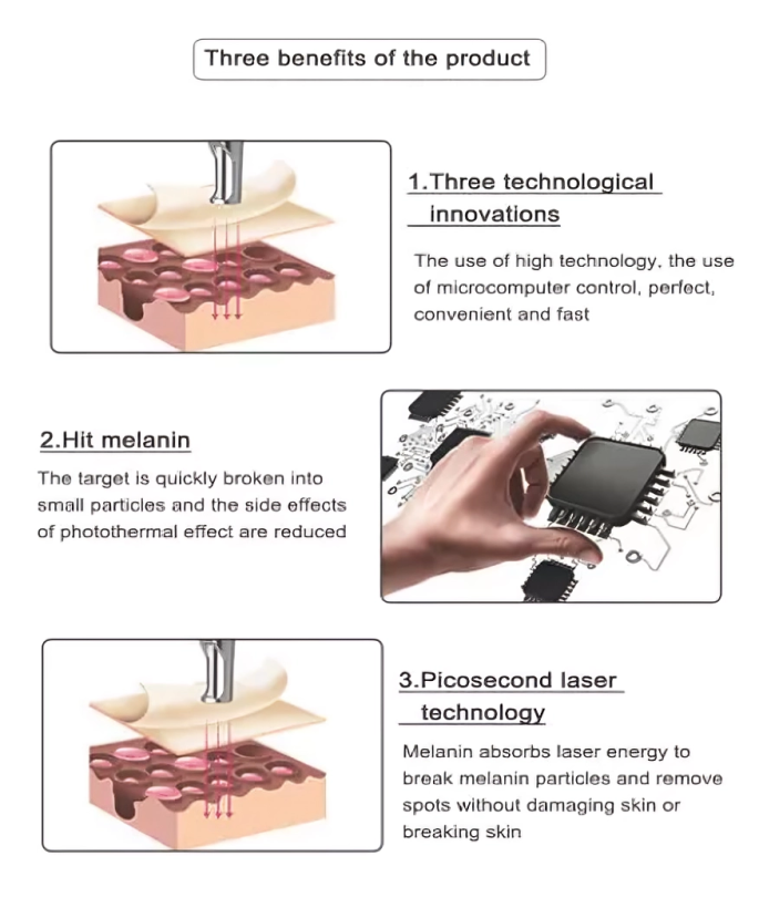 Laser Tattoo Removal Pen